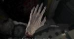 Resident Evil 9 Requiem: How to use the Severed Hand